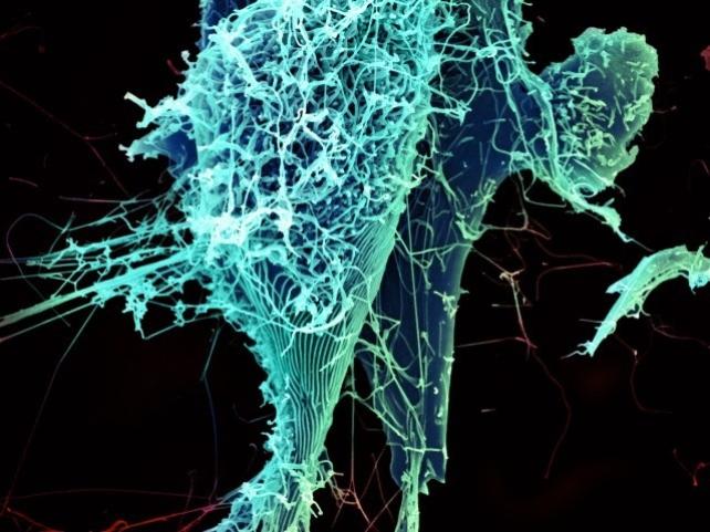Identifican cambios genéticos en el virus del ébola causante del actual brote
