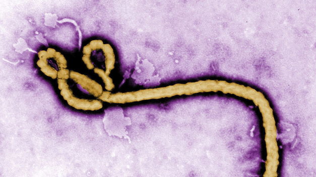 El número de casos de ébola aumenta por primera vez en 2015