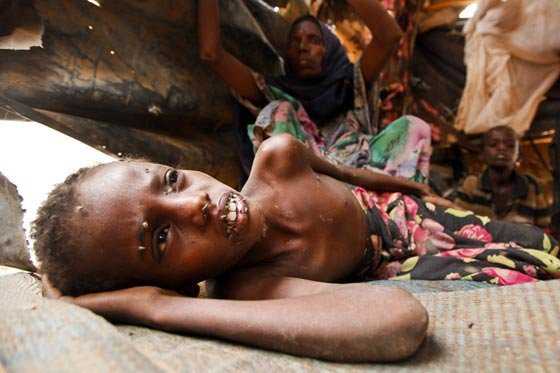 El hambre persiste en Etiopía pese al fin de la sequía