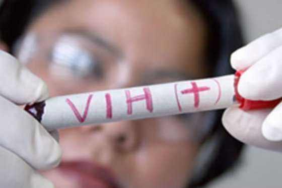 Contagios de VIH en Chile subieron 68,7% en los últimos 10 años